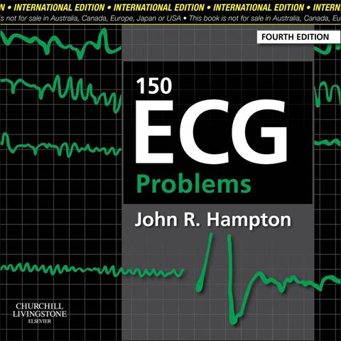 150 ECG Problems