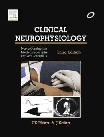 Clinical Neurophysiology Nerve Conduction Electromyography Evoked Potentials