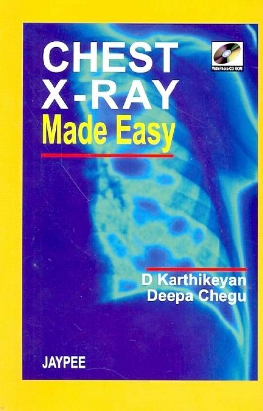 Chest X Ray Made Easy with Photo CD ROM