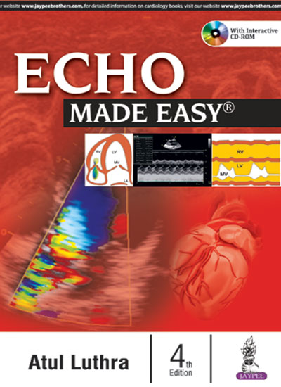 Echo Made Easy with Interactive CD ROM