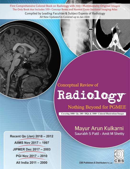 Conceptual Review of Radiology Nothing Beyond for PGMEE