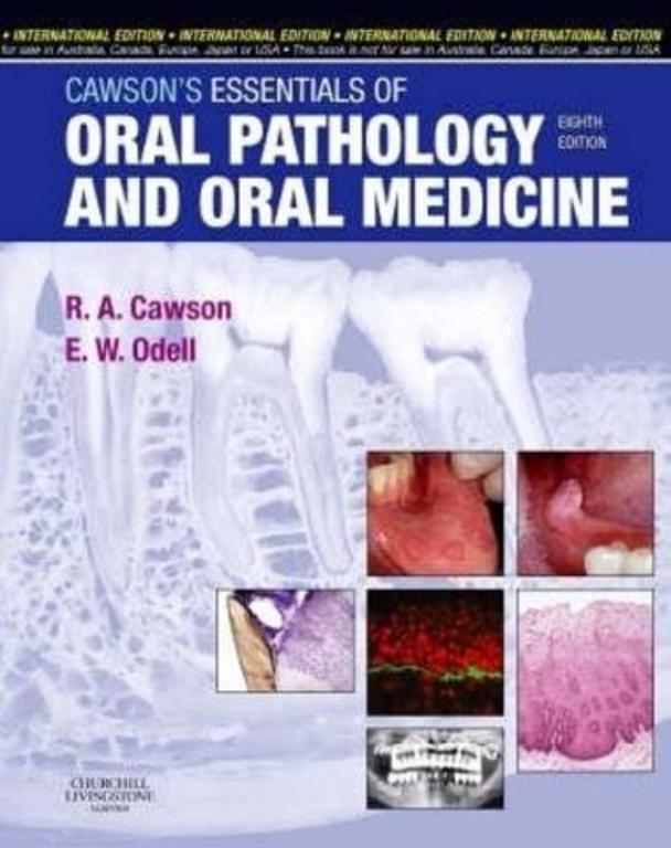 Cawsons Essentials of Oral Pathology and Oral Medicine